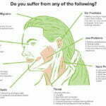 SMUDRA Helps you Achieve Long-Lasting TMJ Pain Relief
