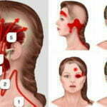 Easy Way To Relieve Migraine And Headache Pain